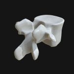 Anatomy – Lumbar vertebra