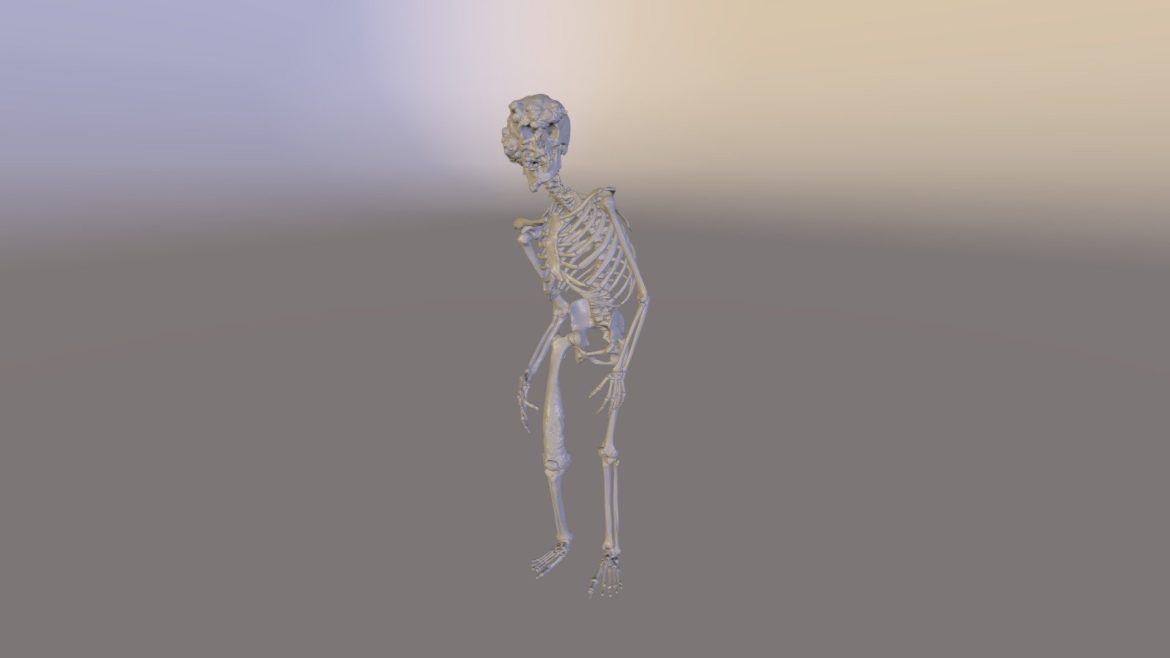 elephant man skeleton.thumb