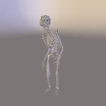 Elephant Man Skeleton